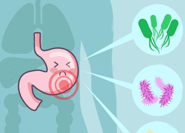 幽門螺桿菌、胃炎和胃潰瘍的諾貝爾獎(jiǎng)之路